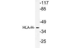 Western blot (WB) analysis of HLA-H antibody in extracts from LOVO cells. (HFE anticorps)