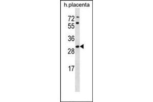 Western blot analysis in human placenta tissue lysates (35ug/lane) using STARD4 Antibody (N-term) Cat. (STARD4 anticorps  (N-Term))