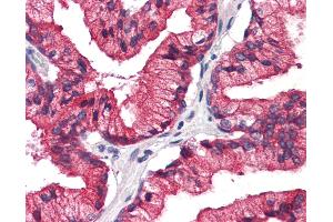 Human, Prostate: Formalin-Fixed Paraffin-Embedded (FFPE)