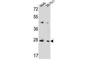 T4S4 Antibody (N-term) western blot analysis in A549,ZR-75-1 cell line lysates (35µg/lane). (TM4SF4 anticorps  (N-Term))