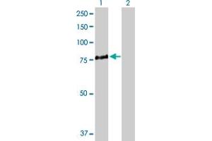 Western Blot analysis of ALOX5 expression in transfected 293T cell line by ALOX5 MaxPab polyclonal antibody. (ALOX5 anticorps  (AA 1-674))