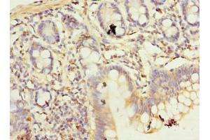Immunohistochemistry of paraffin-embedded human small intestine tissue using ABIN7174699 at dilution of 1:100 (AKNA Domain Containing 1 (AKNAD1) (AA 1-223) anticorps)