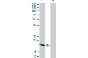 Western Blot analysis of CABP4 expression in transfected 293T cell line by CABP4 monoclonal antibody (M02), clone 5G11. (CABP4 anticorps  (AA 1-170))