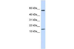 WB Suggested Anti-KRTAP11-1 Antibody Titration:  0. (KRTAP11-1 anticorps  (N-Term))