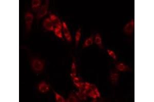 ABIN6275466 staining HeLa by IF/ICC. (RAB33A anticorps  (Internal Region))