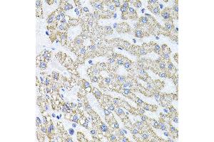 Immunohistochemistry of paraffin-embedded human liver injury using SDC2 antibody at dilution of 1:100 (x40 lens). (Syndecan 2 anticorps)