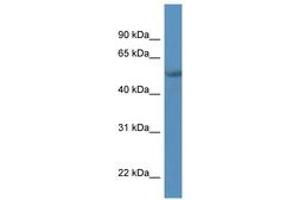 Image no. 1 for anti-Transcriptional Adaptor 2A (TADA2A) (AA 338-387) antibody (ABIN6746060) (TADA2L anticorps  (AA 338-387))