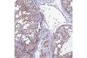 Immunohistochemical staining of human testis with C14orf1 polyclonal antibody  shows distinct staining in spermatids. (C14orf1 anticorps)