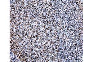 IHC analysis of SP1 using anti-SP1 antibody (ABIN7601559).