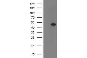 Western Blotting (WB) image for anti-SET Domain Containing (Lysine Methyltransferase) 7 (SETD7) antibody (ABIN1500904) (SETD7 anticorps)