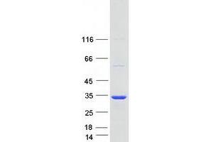 Validation with Western Blot