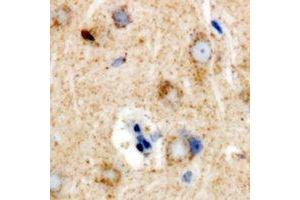 Immunohistochemical analysis of Ribophorin-2 staining in rat brain formalin fixed paraffin embedded tissue section. (Ribophorin II anticorps)