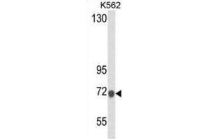 Western Blotting (WB) image for anti-Lactotransferrin (LTF) antibody (ABIN2995307) (Lactoferrin anticorps)