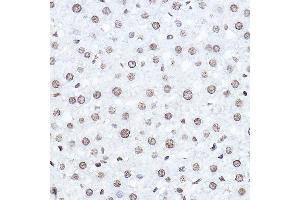 Immunohistochemistry of paraffin-embedded rat liver using SETD5 Rabbit pAb (ABIN6132960, ABIN6147644, ABIN6147646 and ABIN6223140) at dilution of 1:100 (40x lens). (SETD5 anticorps  (AA 520-740))