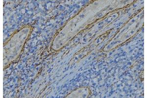 ABIN6274996 at 1/100 staining Human uterus tissue by IHC-P. (CBLN4 anticorps  (Internal Region))