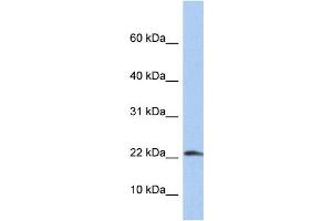 WB Suggested Anti-IL1B Antibody Titration: 0. (IL-1 beta anticorps  (N-Term))