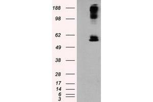 HEK293T cells were transfected with the pCMV6-ENTRY control (Left lane) or pCMV6-ENTRY LIPG (Right lane) cDNA for 48 hrs and lysed. (LIPG anticorps)