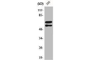 Western Blot analysis of 293 cells using Phospho-Lyn (Y508) Polyclonal Antibody