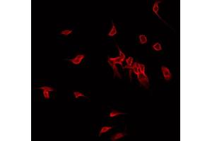 ABIN6267686 staining MDA-MB-435 by IF/ICC.