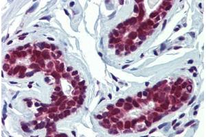 Breast, Human: Formalin-Fixed, Paraffin-Embedded (FFPE)