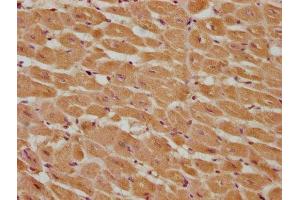 IHC image of ABIN7146968 diluted at 1:285 and staining in paraffin-embedded human heart tissue performed on a Leica BondTM system.