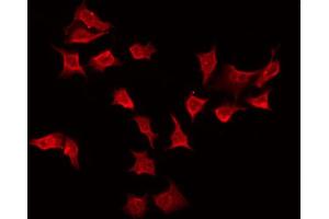 ABIN6274391 staining Hela by IF/ICC. (TSSC1 anticorps)