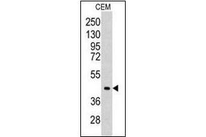 Western blot analysis of CEM cell line lysates (35 µg/lane). (ALDOC anticorps  (C-Term))