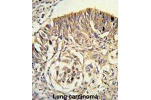 Immunohistochemistry (IHC) image for anti-Phospholipid Transfer Protein (PLTP) antibody (ABIN3003343) (PLTP anticorps)