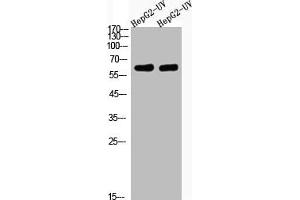 Western Blot analysis of HepG2-UV cells using Acetyl-Cortactin (K235) Polyclonal Antibody (Cortactin anticorps  (acLys235))
