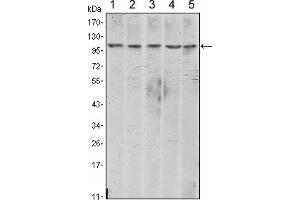 Western blot analysis using CDH2 mouse mAb against A431 (1), NIH/3T3 (2), Hela (3), C6 (4) and LNCap (5) cell lysate. (N-Cadherin anticorps)
