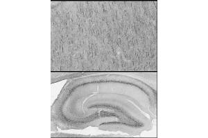 Adult rat cerebral cortex and hippocampus immunohistochemistry with antigen retrieval via pepsin pretreatment. (SPTBN4 anticorps  (C-Term))