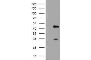 Western Blotting (WB) image for anti-Centromere Protein H (CENPH) antibody (ABIN1497474) (CENPH anticorps)