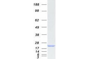 Validation with Western Blot