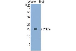 Western Blotting (WB) image for anti-Acid Phosphatase 1, Soluble (ACP1) (AA 1-158) antibody (ABIN1077730)