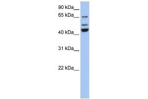 WB Suggested Anti-VPS4A Antibody Titration: 0. (VPS4A anticorps  (N-Term))