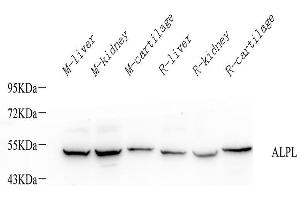 Western Blot analysis of various samples using ALPL Polyclonal Antibody at dilution of 1:1000.
