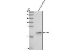 Western blot analysis of PTP4A2 using anti-PTP4A2 antibody (AZQ5U3R3).