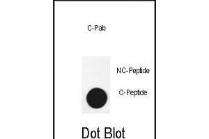 Dot blot analysis of anti-G3-cleaved Pab 3740a on nitrocellulose membrane. (ATG3 anticorps  (AA 90-104))
