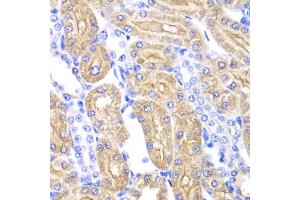 Immunohistochemistry of paraffin-embedded rat kidney using ALDH2 antibody (ABIN5970568) at dilution of 1/100 (40x lens). (ALDH2 anticorps)