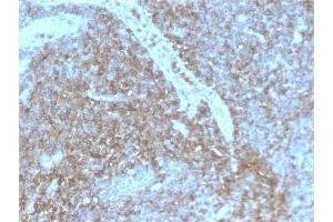 Formalin-fixed, paraffin-embedded human Lymph Node stained with CD44 Rabbit Recombinant Monoclonal Antibody (HCAM/2875R).