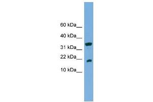 WB Suggested Anti-ACP1  Antibody Titration: 0. (ACP1 anticorps  (Middle Region))