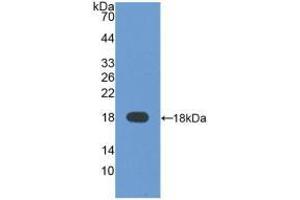 WB of Protein Standard: different control antibodies against Highly purified E. (alpha Fetoprotein Kit CLIA)