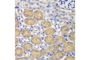 Immunohistochemistry of paraffin-embedded mouse kidney using SND1 antibody at dilution of 1:100 (40x lens). (SND1 anticorps)
