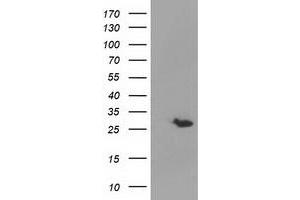 Western Blotting (WB) image for anti-Glutathione S-Transferase theta 2 (GSTT2) antibody (ABIN1498554) (GSTT2 anticorps)