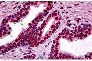 Human Prostate: Formalin-Fixed, Paraffin-Embedded (FFPE) (MEF2A anticorps  (AA 71-170))