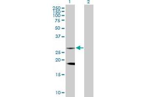 Western Blot analysis of CLTB expression in transfected 293T cell line by CLTB MaxPab rabbit polyclonal antibody. (CLTB anticorps  (AA 1-211))