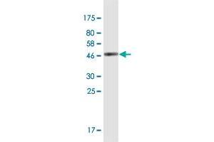 Western Blot detection against Immunogen (42 KDa) . (SPANXN3 anticorps  (AA 1-141))