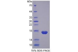 SDS-PAGE analysis of Pig FABP2 Protein. (FABP2 Protéine)