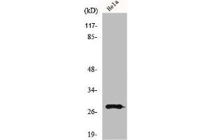 Western Blot analysis of HeLa cells using MRRF Polyclonal Antibody