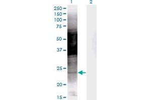 Western Blot analysis of PRKCDBP expression in transfected 293T cell line by PRKCDBP monoclonal antibody (M04), clone 8D3.